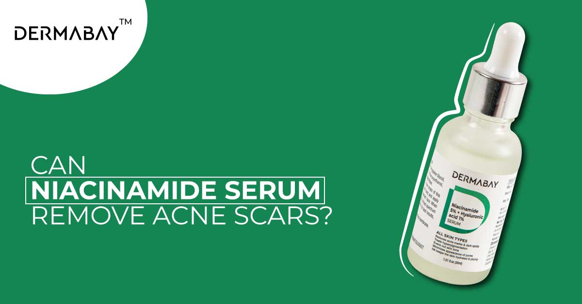 Can Niacinamide Serum Remove Acne Scars? - Dermabay